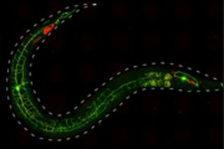 Das Bild zeigt einen Fadenwurm (C. elegans), dessen Nozizeptor Neuron PVD zwei fluoreszierende Proteine exprimiert: GFP (grün) und ChR2::mCherry (rot). Die dünnen Fortsätze von PVD decken die ganze Körperseite ab und können verschiedene Stimuli detektieren, z.B. harsche mechanische Manipulation.